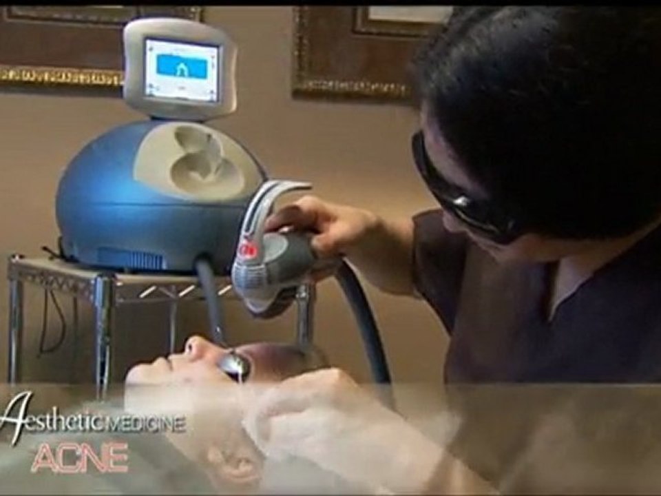 Treatment of Acne