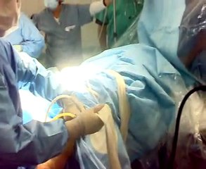 arthroscopie à taroudant