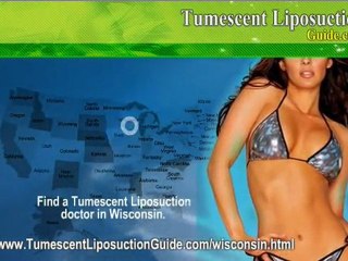 Tumescent Liposuction Wisconsin