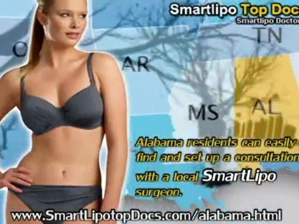SmartLipo Top Docs Alabama