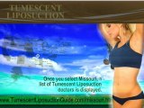 Tumescent Liposuction Missouri