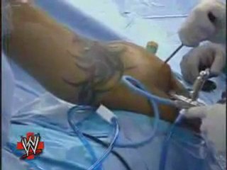 WWE Emergency Room Randy Orton