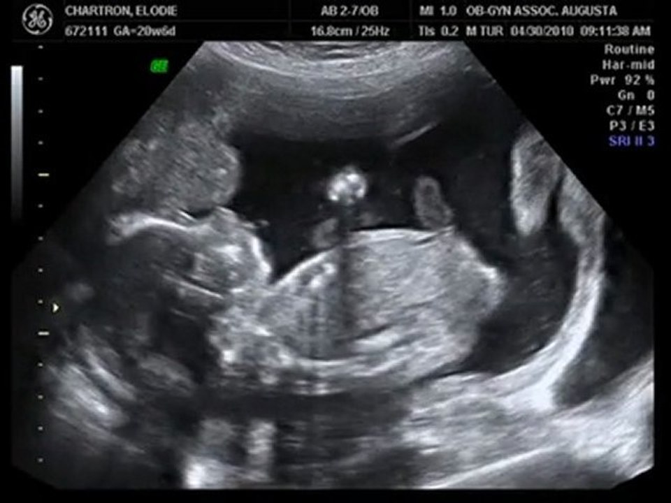 Petit bébé deviendra grand - 4 mois et demi - Avril 2010