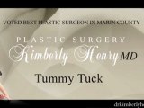 San Francisco Bay Area Tummy Tuck – Abdominoplasty