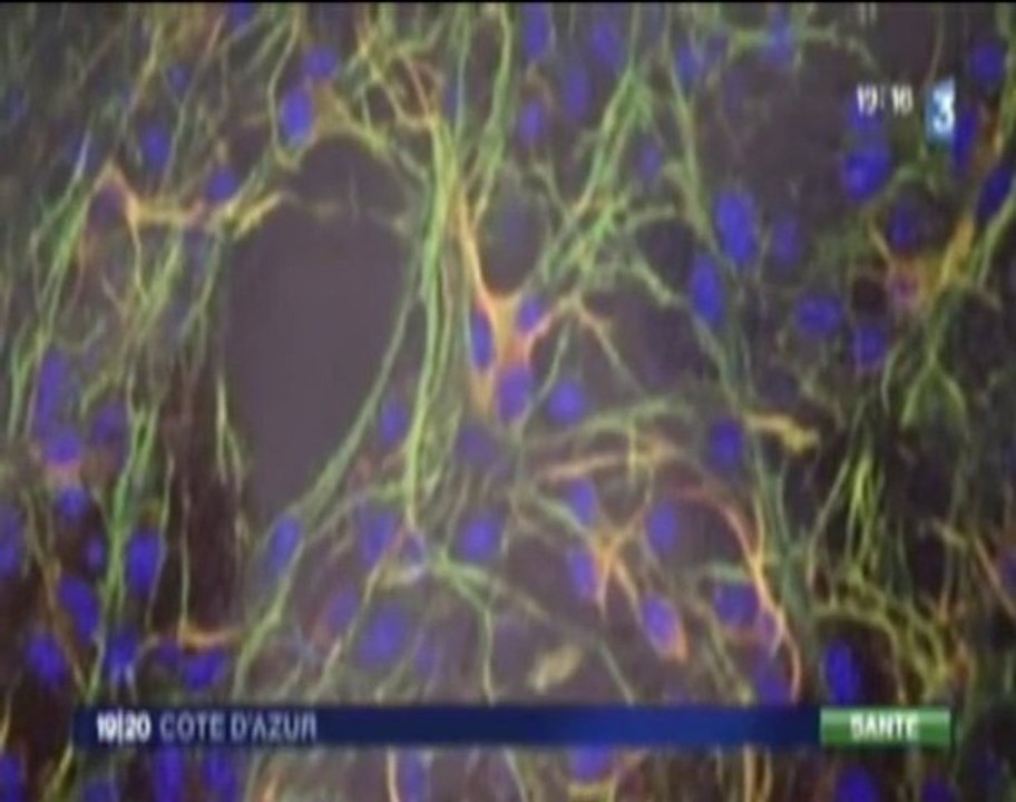 Semaine du Cerveau 2010 en Côte d'Azur - Reportage France 3 19/20