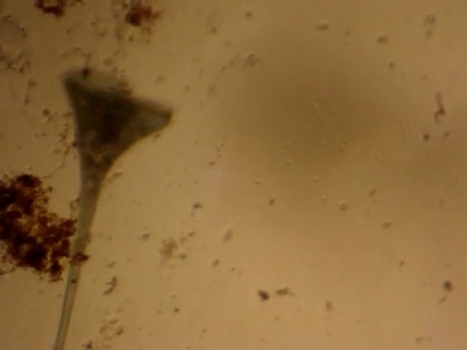 Stentor coeruleus