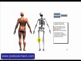 Charlotte Scoliosis Pain Doctor Treatment