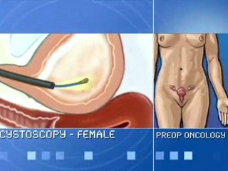 Oncology Patient Education Cancer Surgery Center