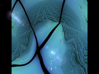 PERLE  ALAIN MOISSET