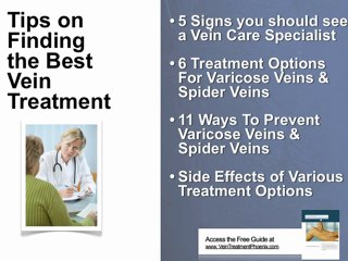 Varicose Veins – Its Causes And Treatments