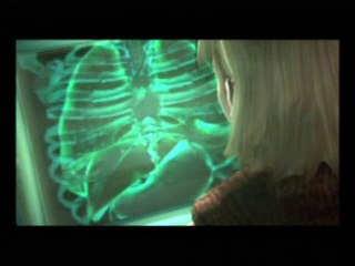 Resident Evil 4 Walkthrough #54 Barbecue de parasites