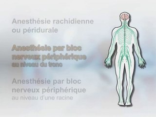 L'anesthésie loco-regionale