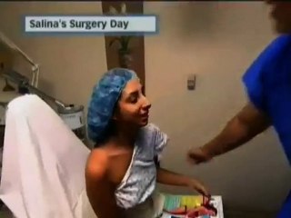 Rhinoplasty Beverly Hills