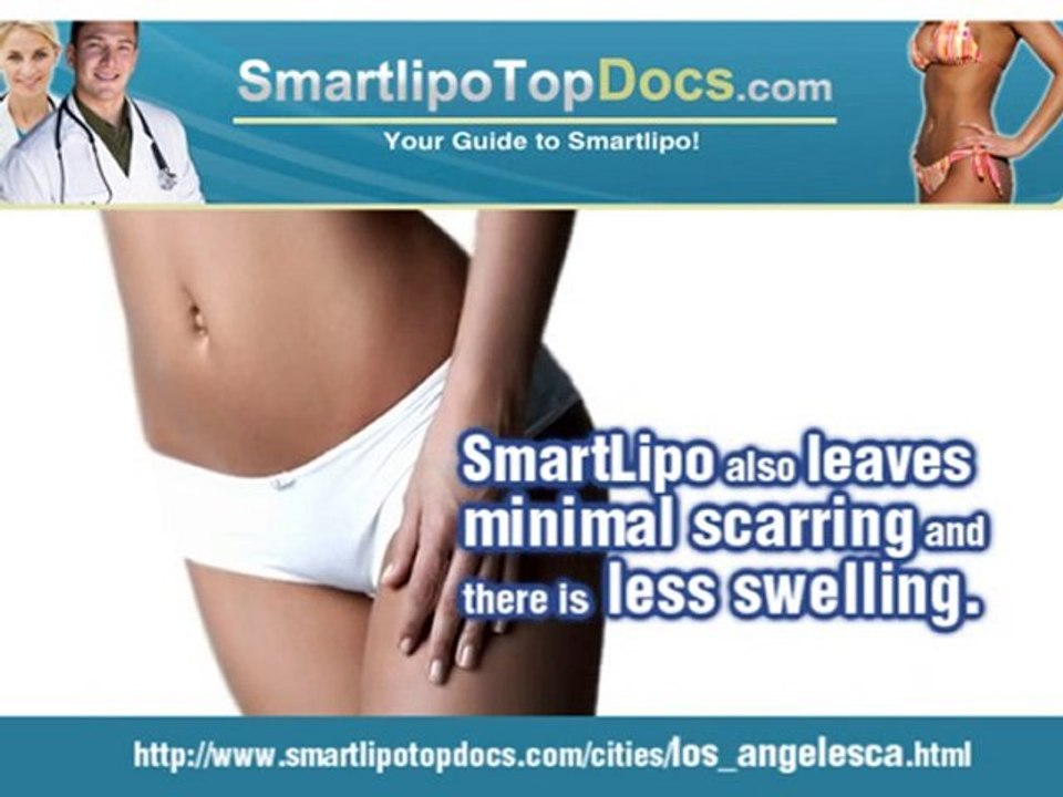 SmartLipo Los Angeles