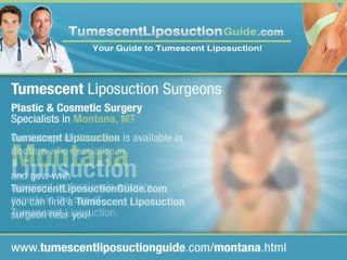Tumescent Liposuction Montana