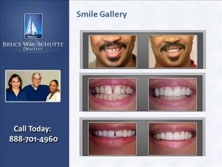 Schutte Dentistry - Cosmetic Dentist West Covina