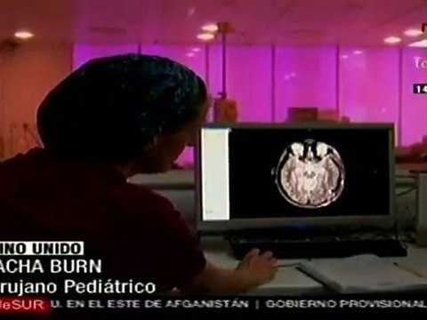 Cirugía permite extirpar tumores cerebrales