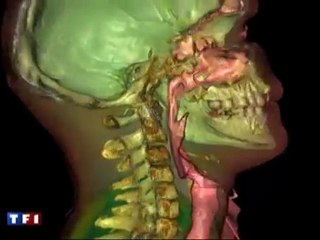 URDIA EA 4465 - Anatomie 3D a l'Universite Paris Descartes