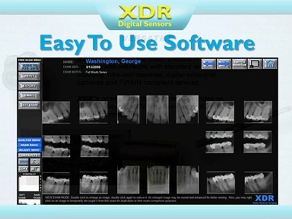 XDR Digital X-Ray Systems from www.DentalSensors.com