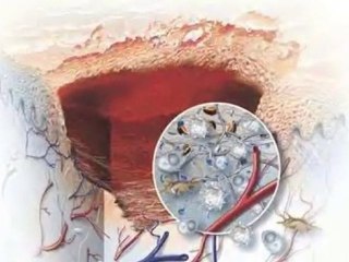 InviCible Scars Advanced Scar Treatment