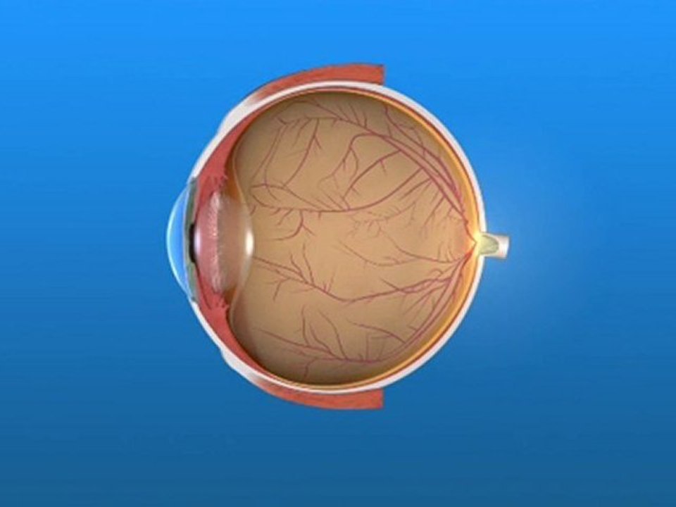 AMD & your eye