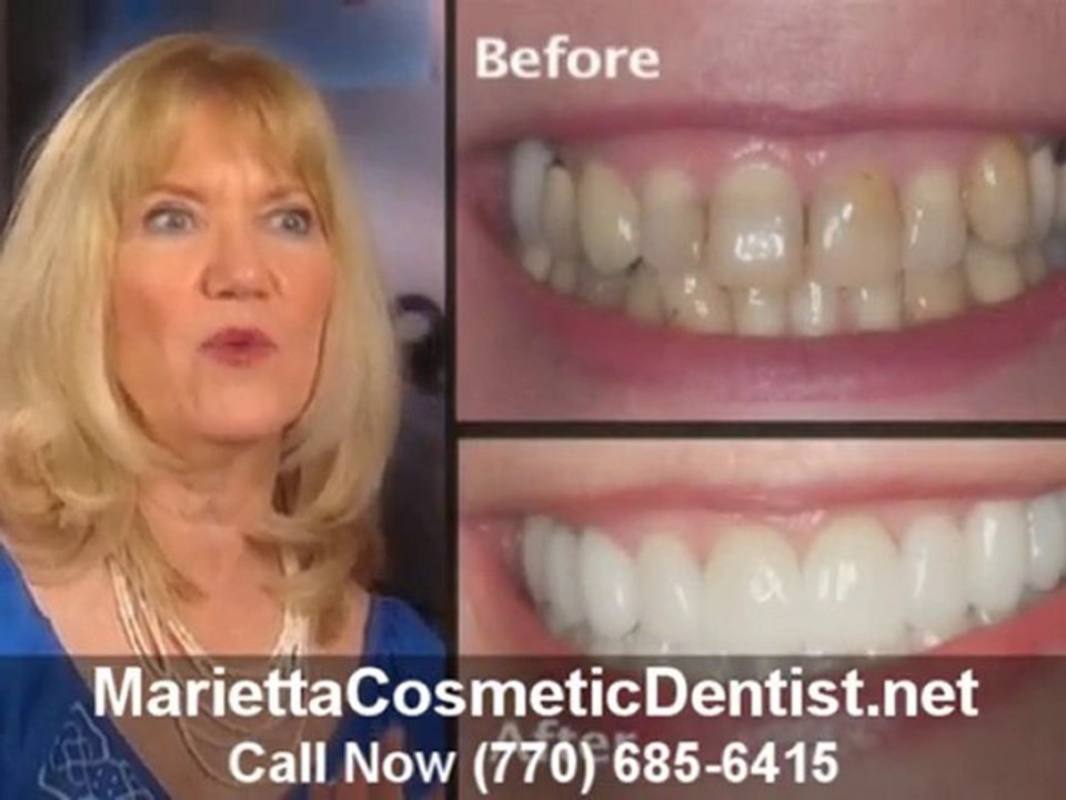 Marietta Cosmetic Dentistry