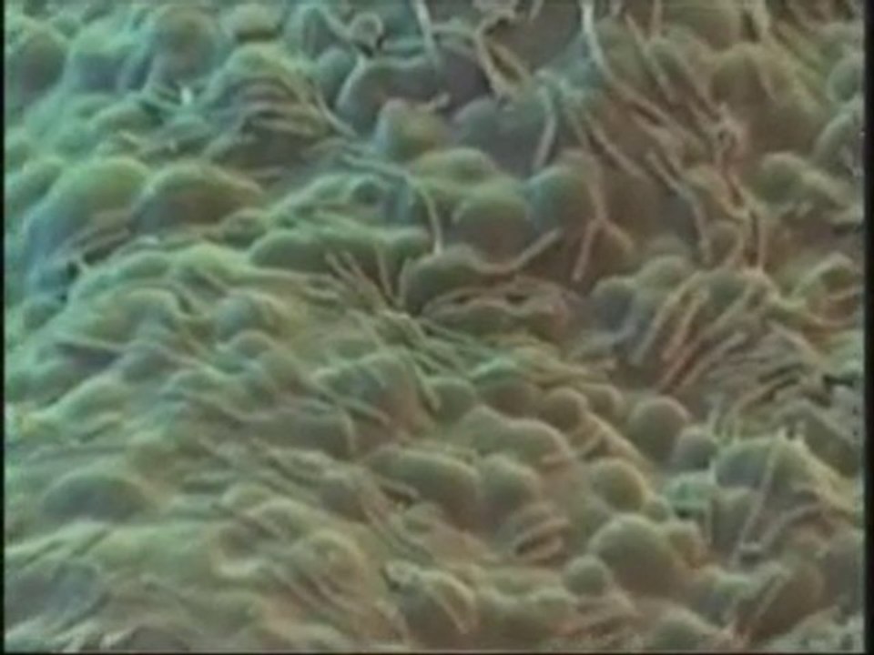 Miracle of the immune system 1/4   www.harunyahya.com