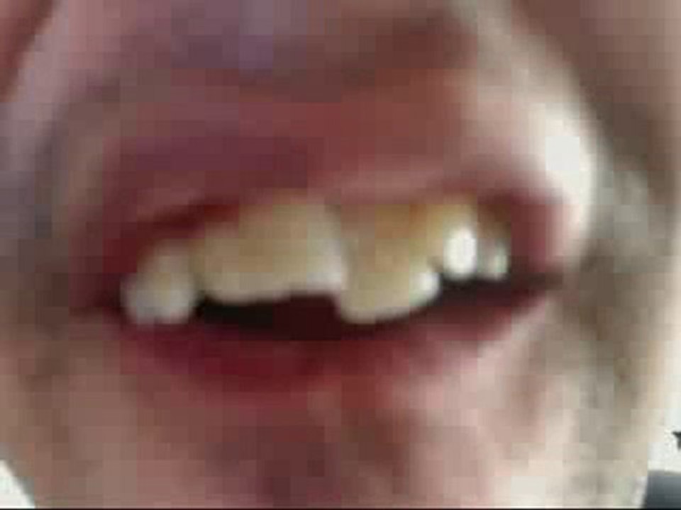 Braces monmouth county NJ,Braces freehold ...