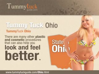 Tummy Tuck Ohio