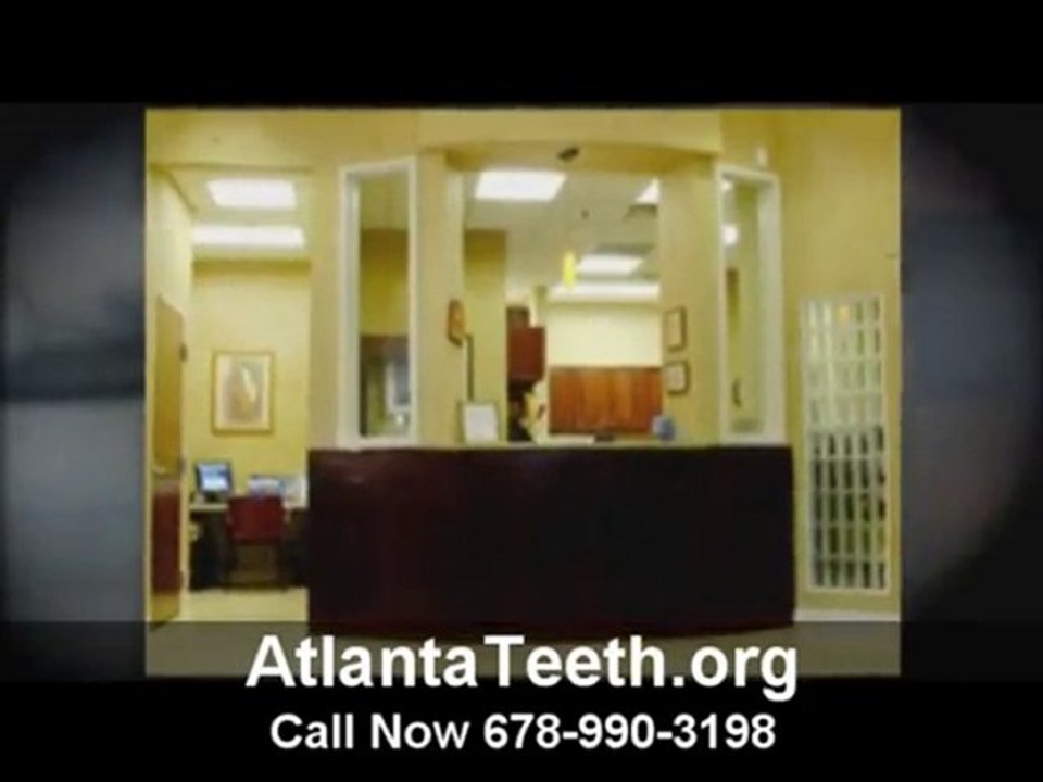 Atlanta Teeth Veneers