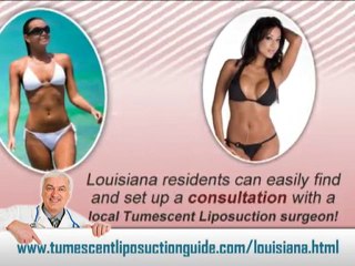 Tumescent Liposuction Louisiana