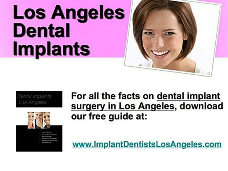 LOS ANGELES DENTAL IMPLANTS GUIDE