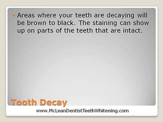 McLean VA Dentist Teeth Whitening – What causes tooth sta