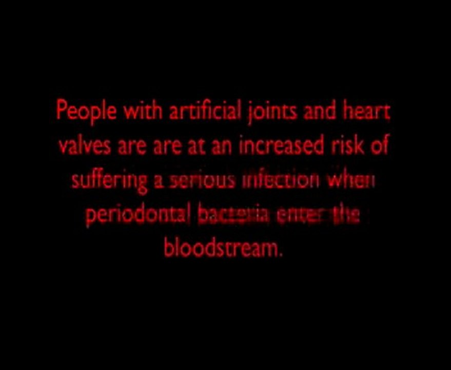 Forest Hills NY Dentist- Dentist in Forest Hills NY