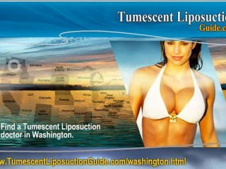 Tumescent Liposuction Washington