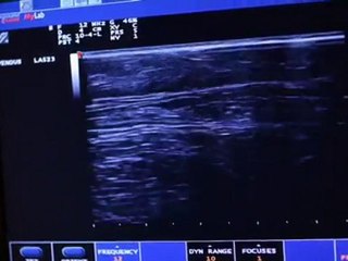 Patient Follow Up Care – Vein & Cosmetic Center Tampa Bay