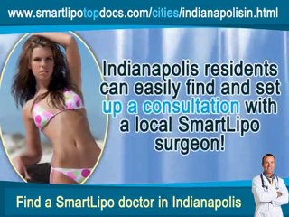 SmartLipo Top Docs Indianapolis