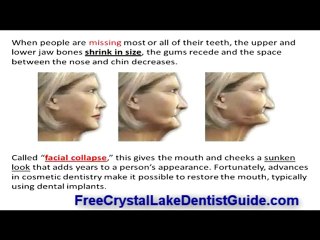 Avoiding The Road TO Tooth Loss