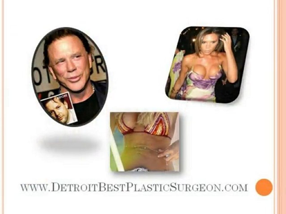 Plastic Surgery Victims