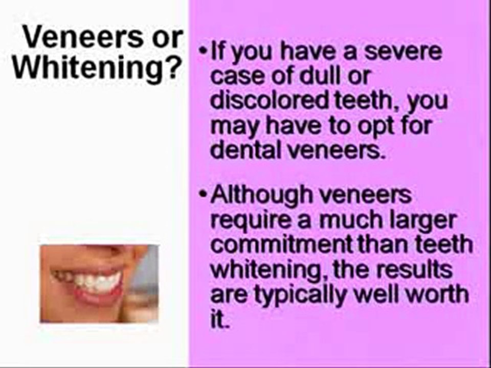 Cosmetic Dentist Whitening or Veneers in New Haven CT,