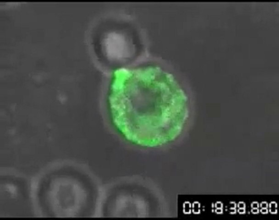hiv attack