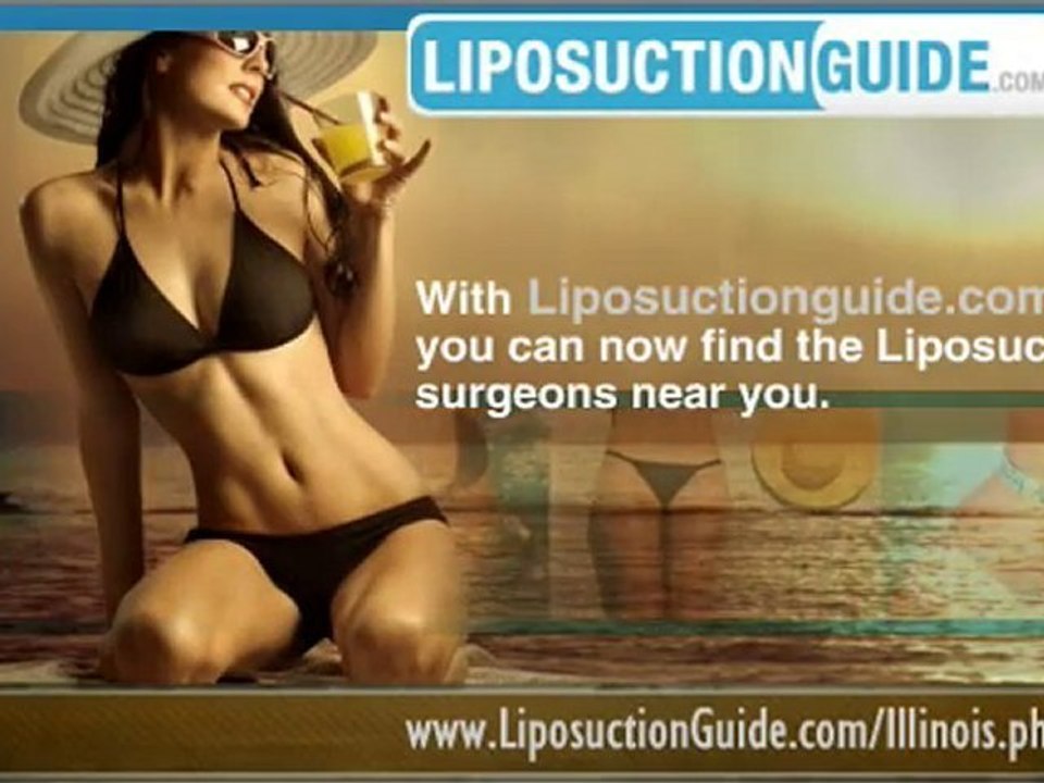 Liposuction Illinois