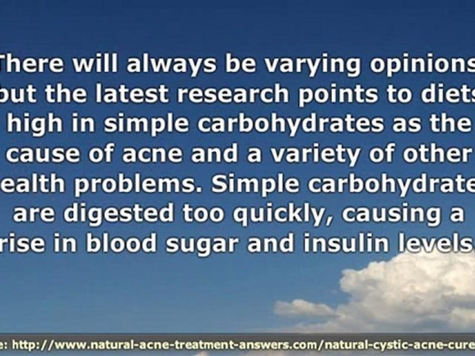 Acne Cystic Natural Treatment - Stop Eating These Foods That