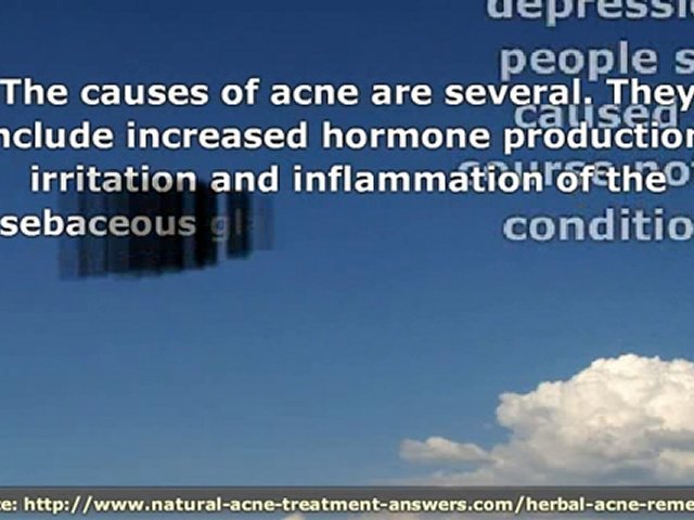 Acne Herbal Remedies - Soothe Acne Inflammation and Prevent