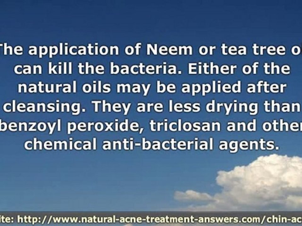 Chin Acne and How to Stop Acne Breakouts With These Simple C