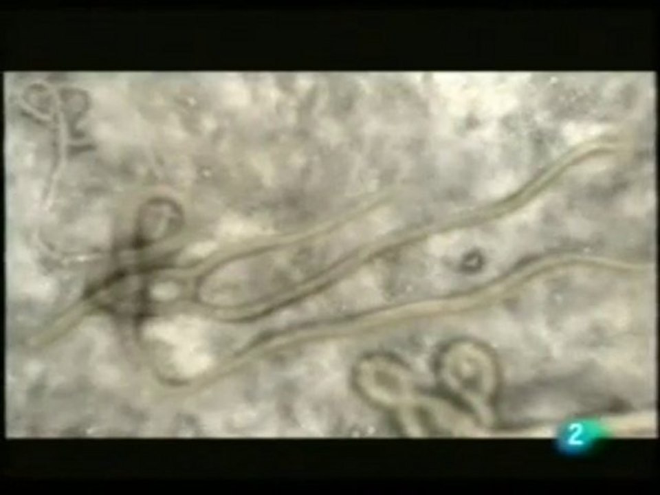 Virus ebola