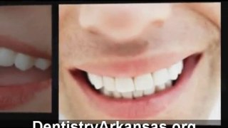 Dentisitry Little Rock