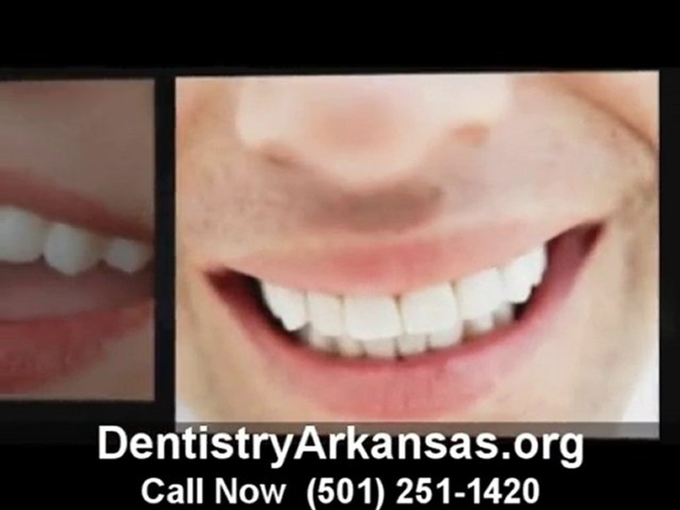 Dentisitry Little Rock