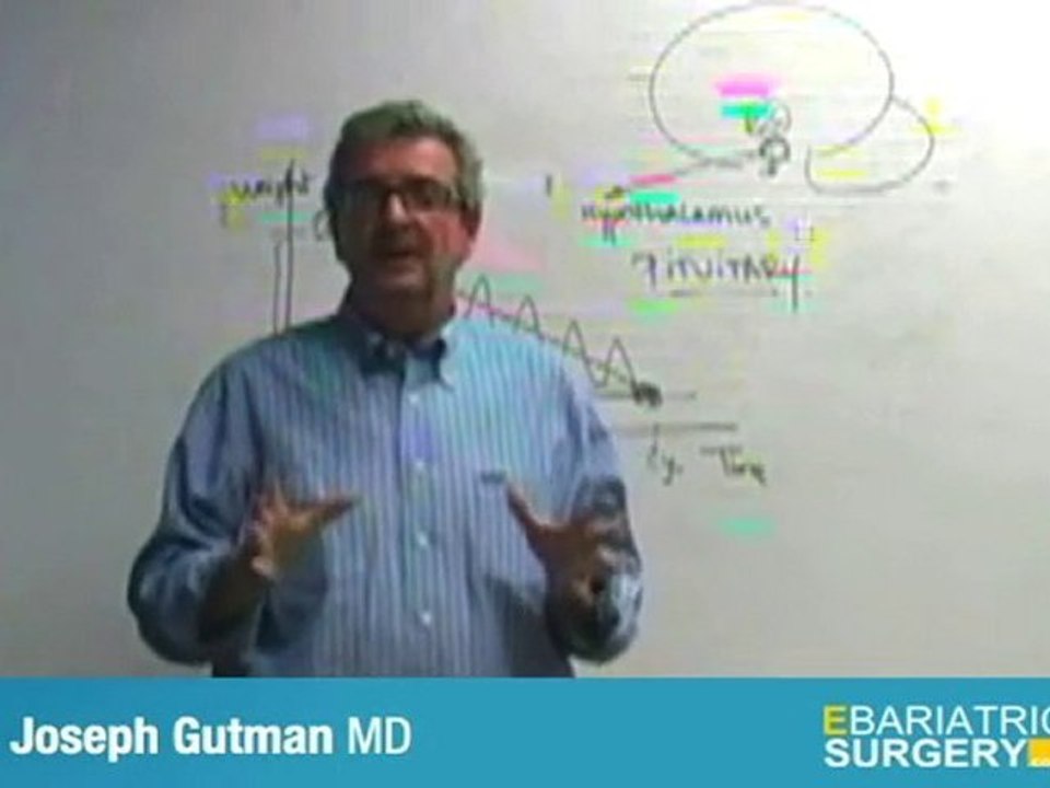 Bariatric Surgery