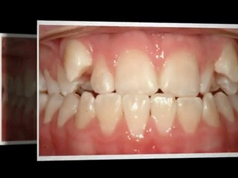 Westminster Orthodontist great new smiles